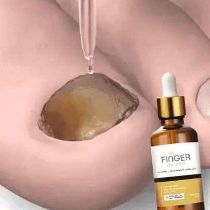 My Finger Solution – Tratamiento Completo Antihongos